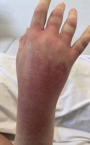   14-          