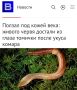 «Ползал под кожей века: живого червя достали из глаза томички после укуса комара»: