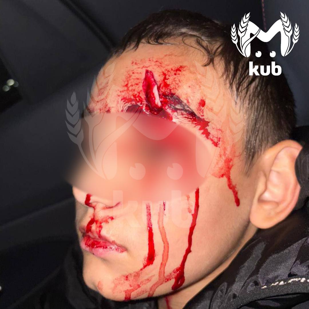 Подросток разбил голову на детской площадке в Белореченском районе