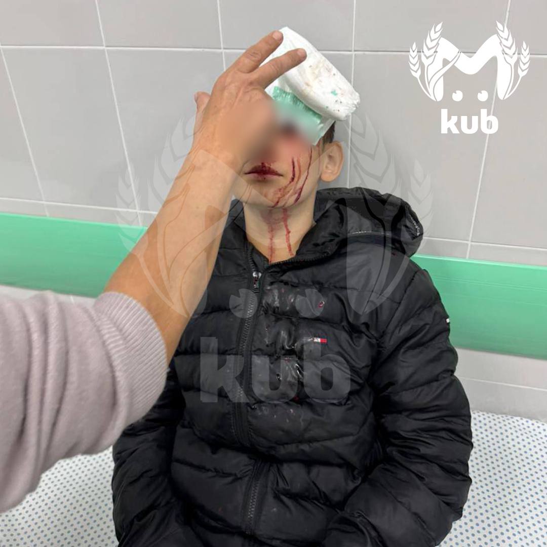 Подросток разбил голову на детской площадке в Белореченском районе Подросток разбил голову на детской площадке в Белореченском районе