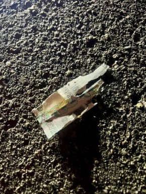 Десятилетнему мальчику оторвало пальцы — он поднял с земли деньги