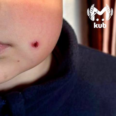 Ребёнок получил пулю в лицо из пневмата в Туапсе