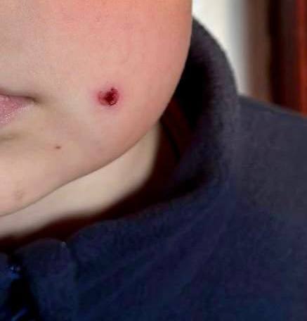 В Туапсе неизвестный выстрелил из пневматического ружья в 9-летнего мальчика