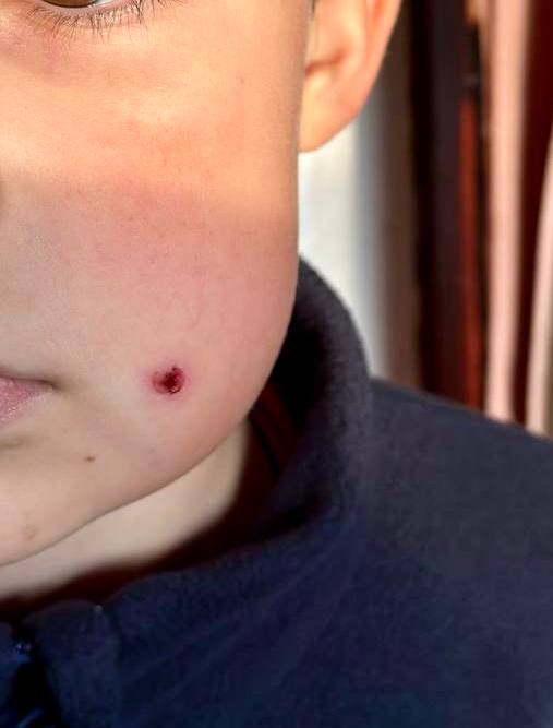 В Туапсе полицейские разыскивают стрелка, который открыл огонь по девятилетнему ребенку на детской площадке на улице Шаумяна