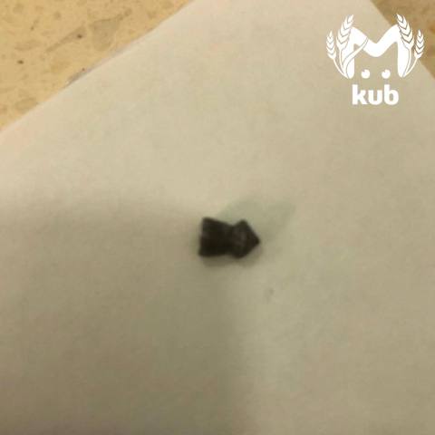 Ребёнок получил пулю в лицо из пневмата в Туапсе Ребёнок получил пулю в лицо из пневмата в Туапсе