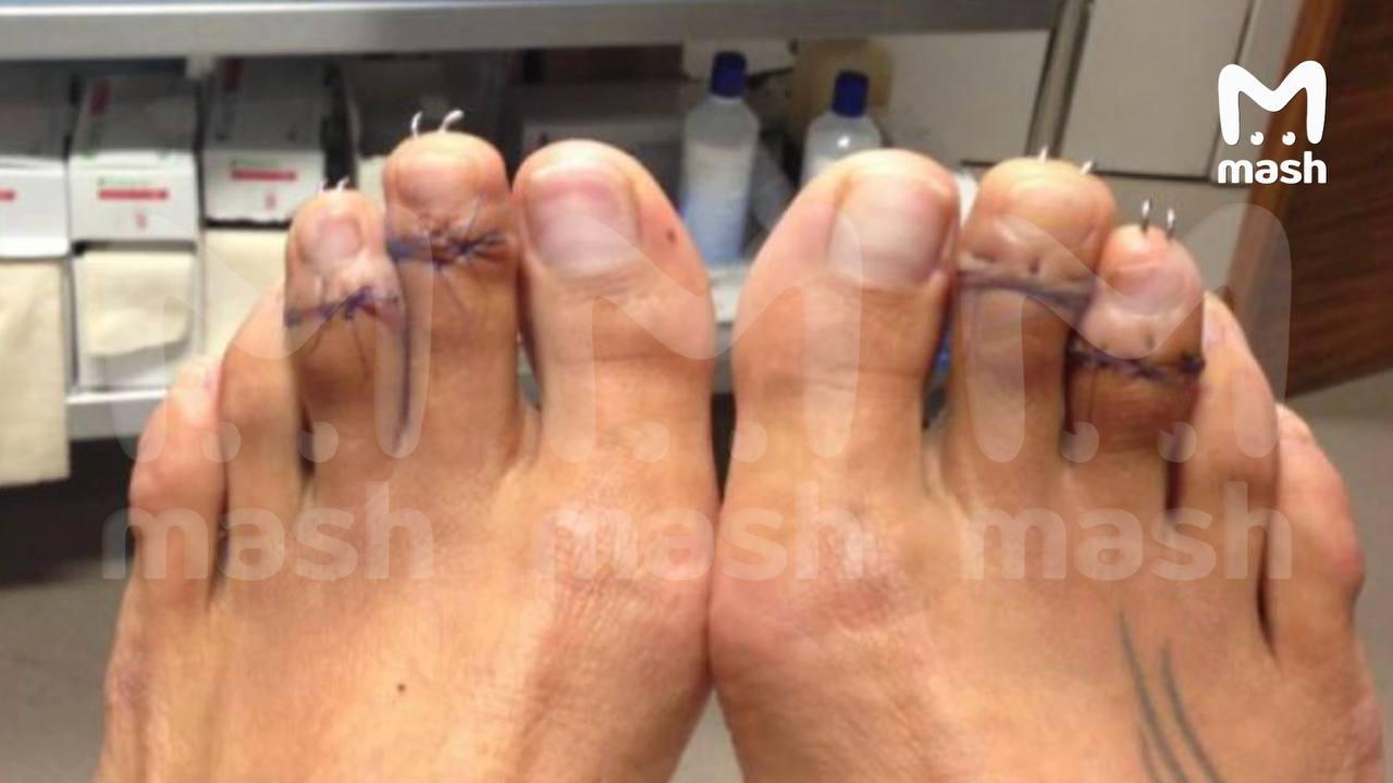 Новый тренд 2026 года: укороченные пальцы ног