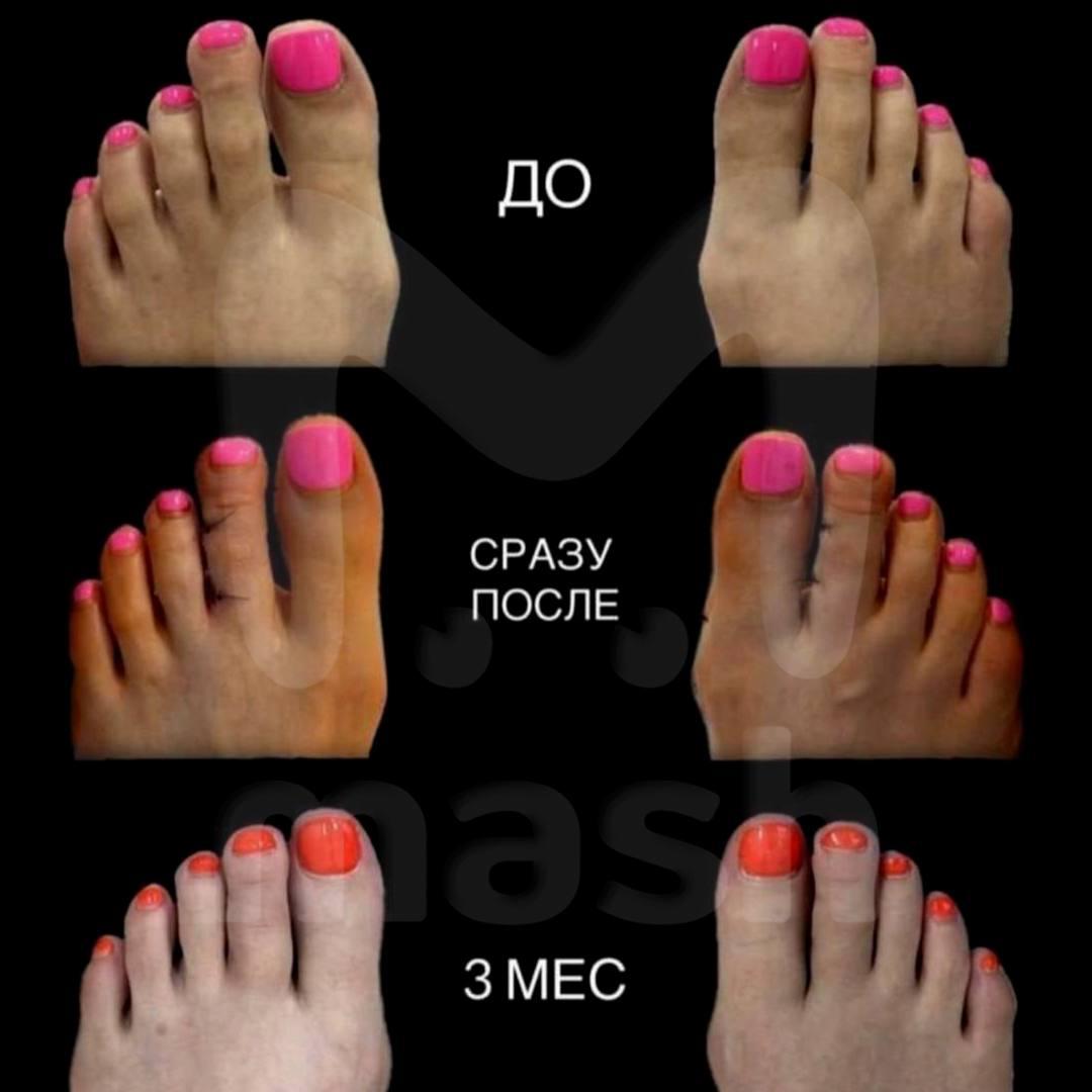 Новый тренд 2026 года: укороченные пальцы ног Новый тренд 2026 года: укороченные пальцы ног