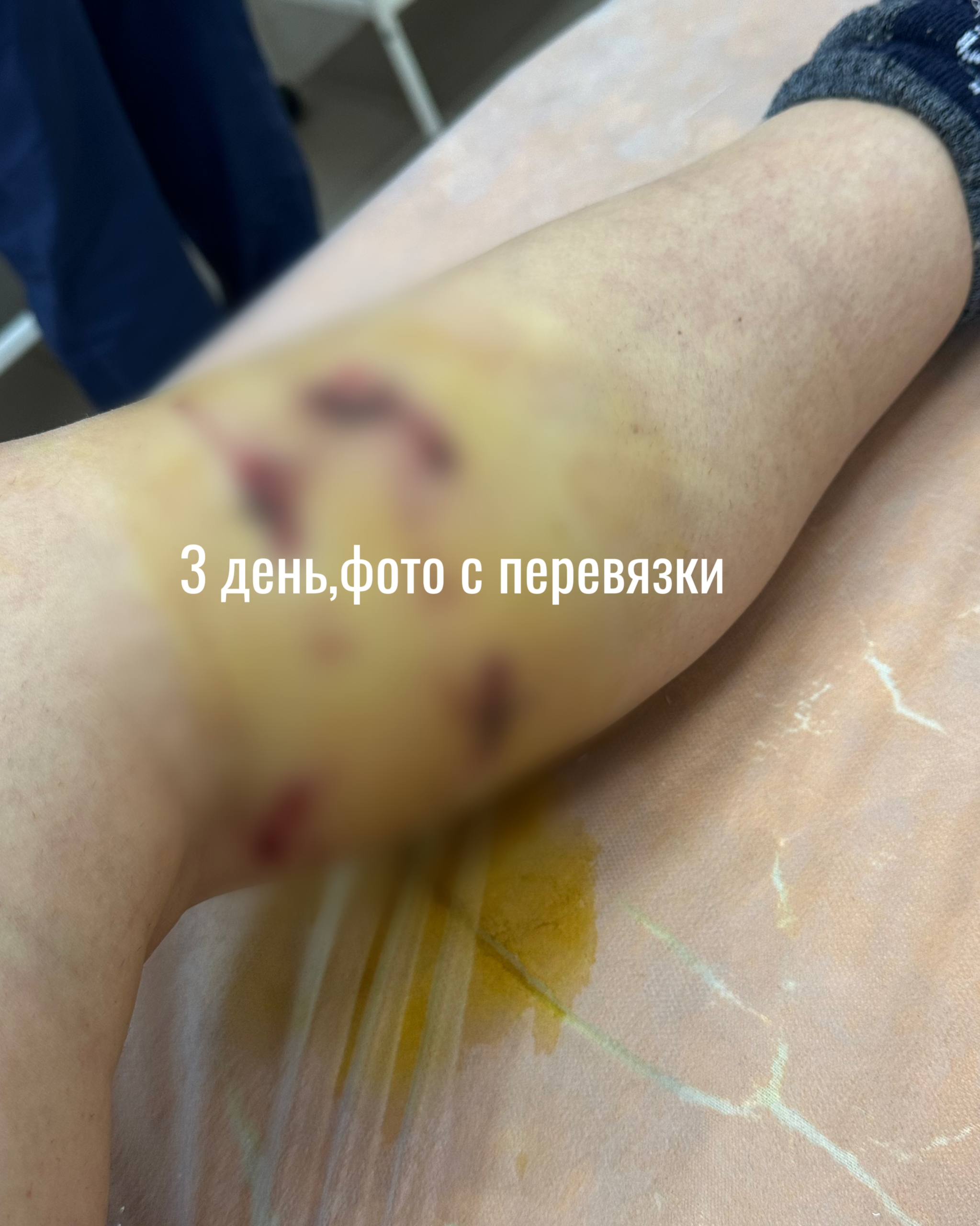 В Краснодаре на людей напала собака В Краснодаре на людей напала собака