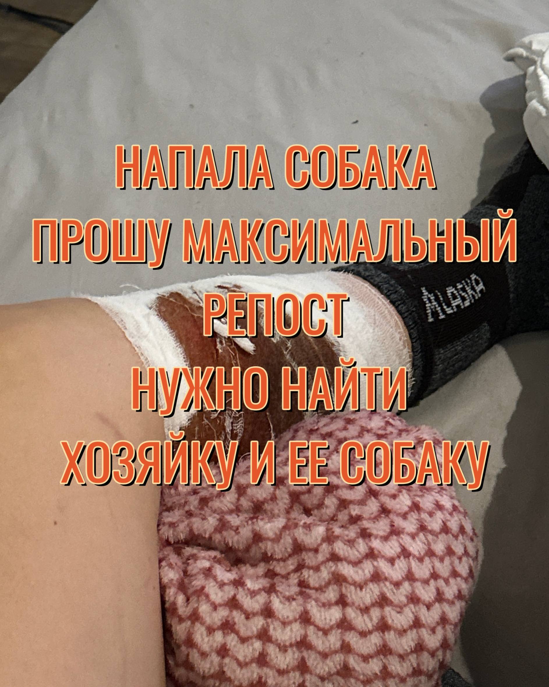 В Краснодаре на людей напала собака В Краснодаре на людей напала собака