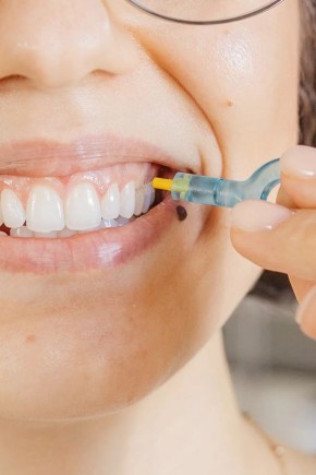 ��� �������� ���� � �������� ��������: ���� � ����������