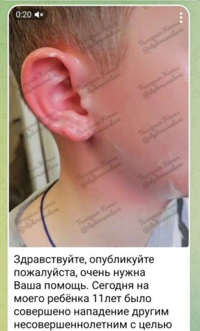 ��������� �� �����. ���� ����������� ���� ������ 11-������� �������� ������