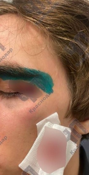 ������� ������ ������������� ��������� �� ��������������