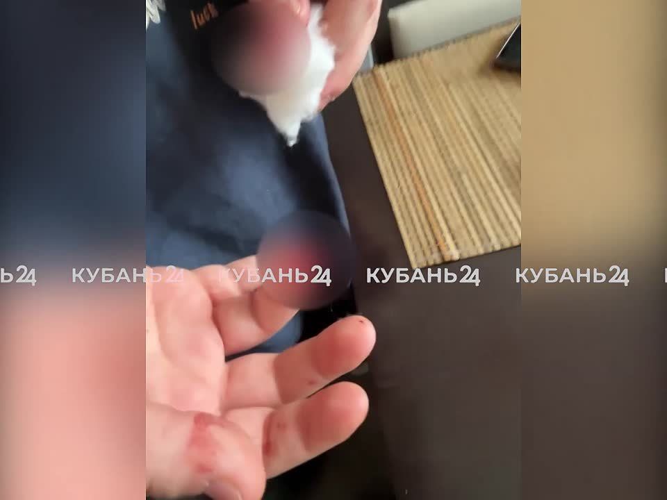 Работник квеста случайно отсек девочке палец дверью в Краснодаре