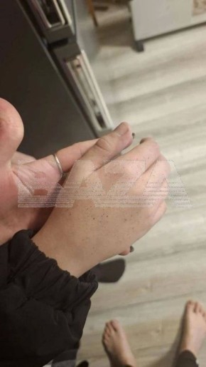 � ������ ������������� ���������� ������� �������, ������� � ���� � ������� ����� ������, ���������� ��-�� ����� �������������