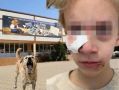 Школа №73 больше года не подавала заявки на отлов собак — после укуса девочки получила предостережение
