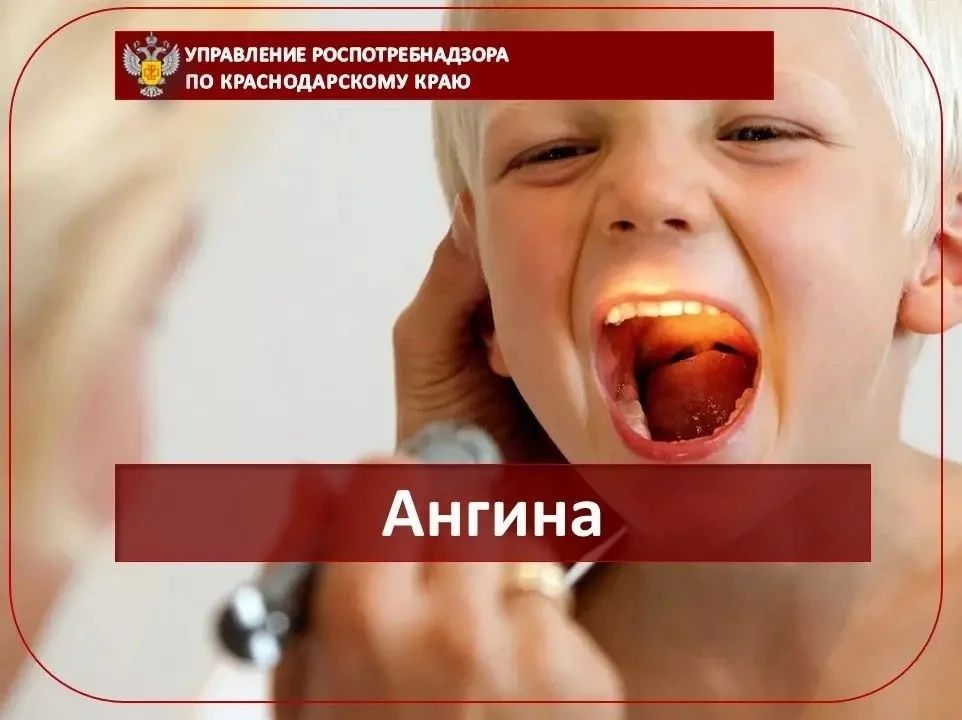 Ангина. Острый тонзиллит или ангина является далеко не безобидным заболеванием, как считают многие