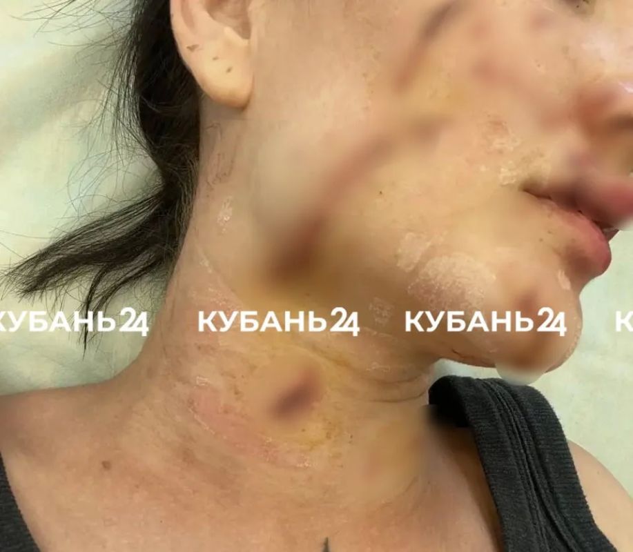 Разбила об лицо бокал, а потом ударила головой об столб: о драке в Горячем Ключе рассказала подписчица Разбила об лицо бокал, а потом ударила головой об столб: о драке в Горячем Ключе рассказала подписчица