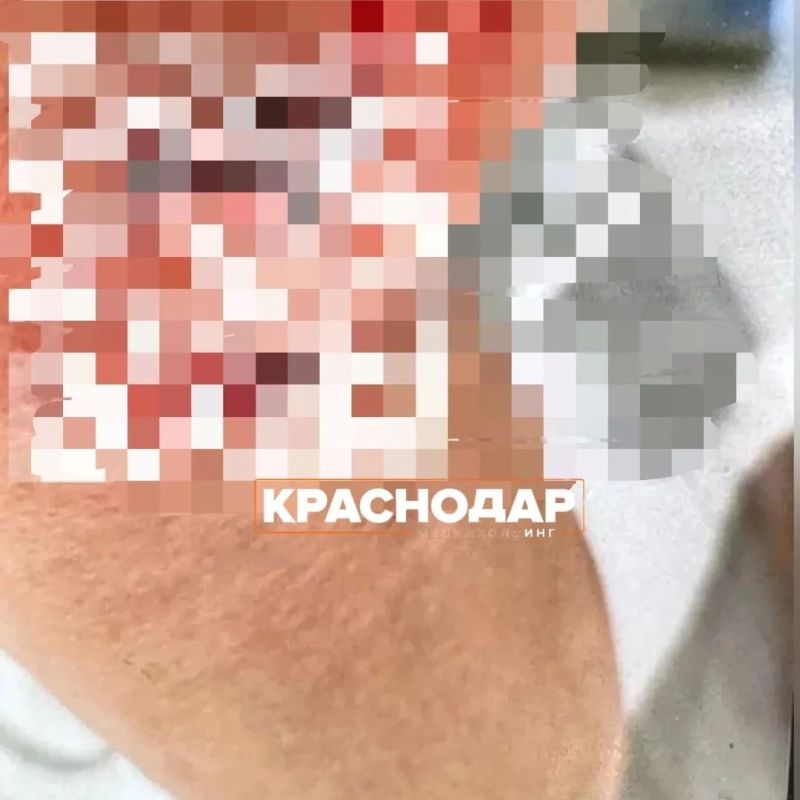 Собака напала на женщину в Новознаменском