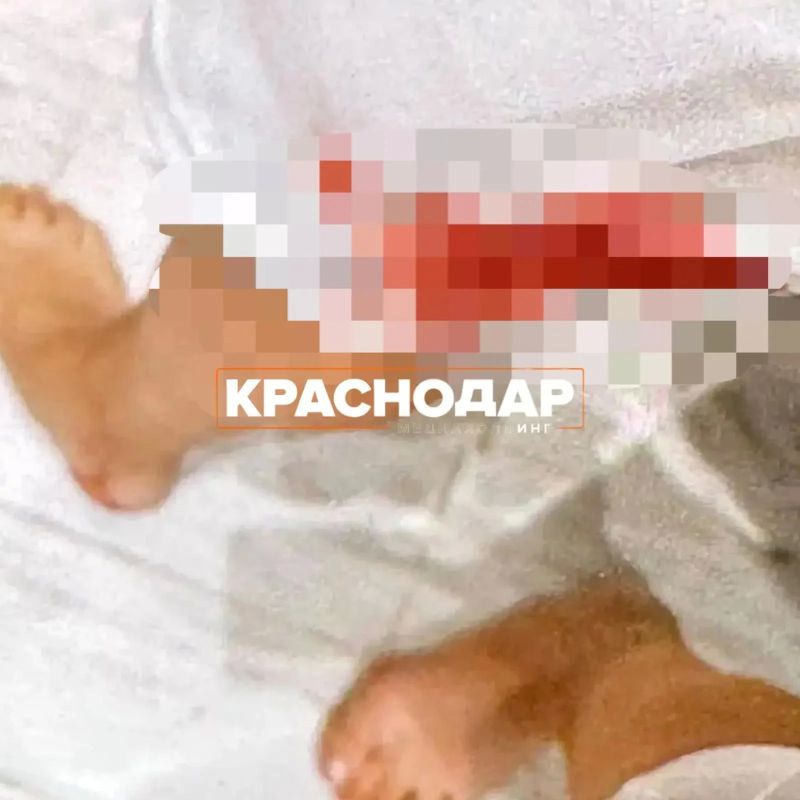 Собака напала на женщину в Новознаменском Собака напала на женщину в Новознаменском