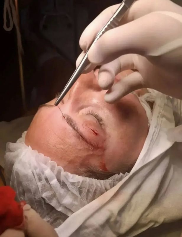 Ползал под веком. Укус комара стал настоящим испытанием для жительницы Крымска Ползал под веком. Укус комара стал настоящим испытанием для жительницы Крымска