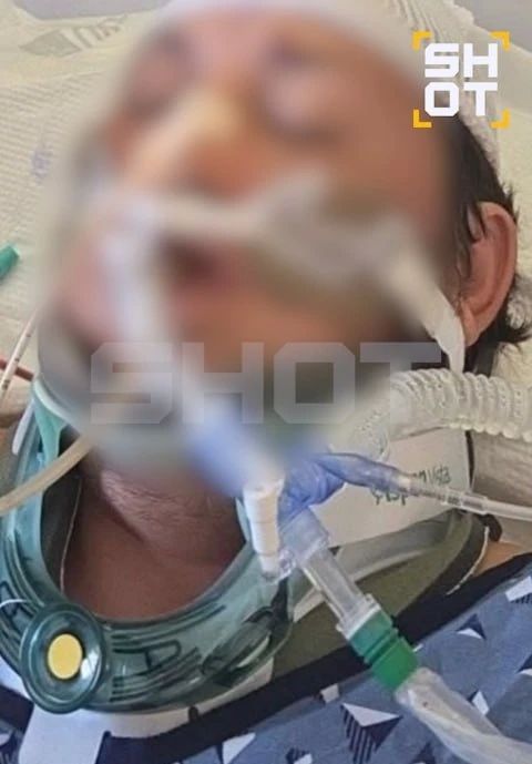Россиянин впал в кому после аварии на электроскутере в Калифорнии Россиянин впал в кому после аварии на электроскутере в Калифорнии