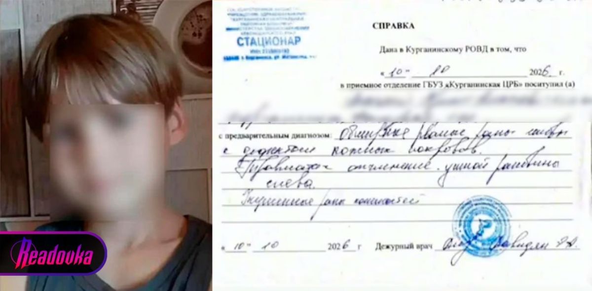 Охранник карпятника в Курганинске натравил на детей свору питбулей — один ребенок в коме