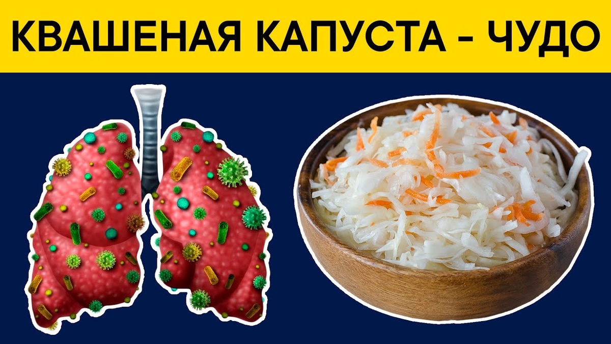 Капуста для кишечника: чем полезен доступный овощ и когда он не заменит добавки